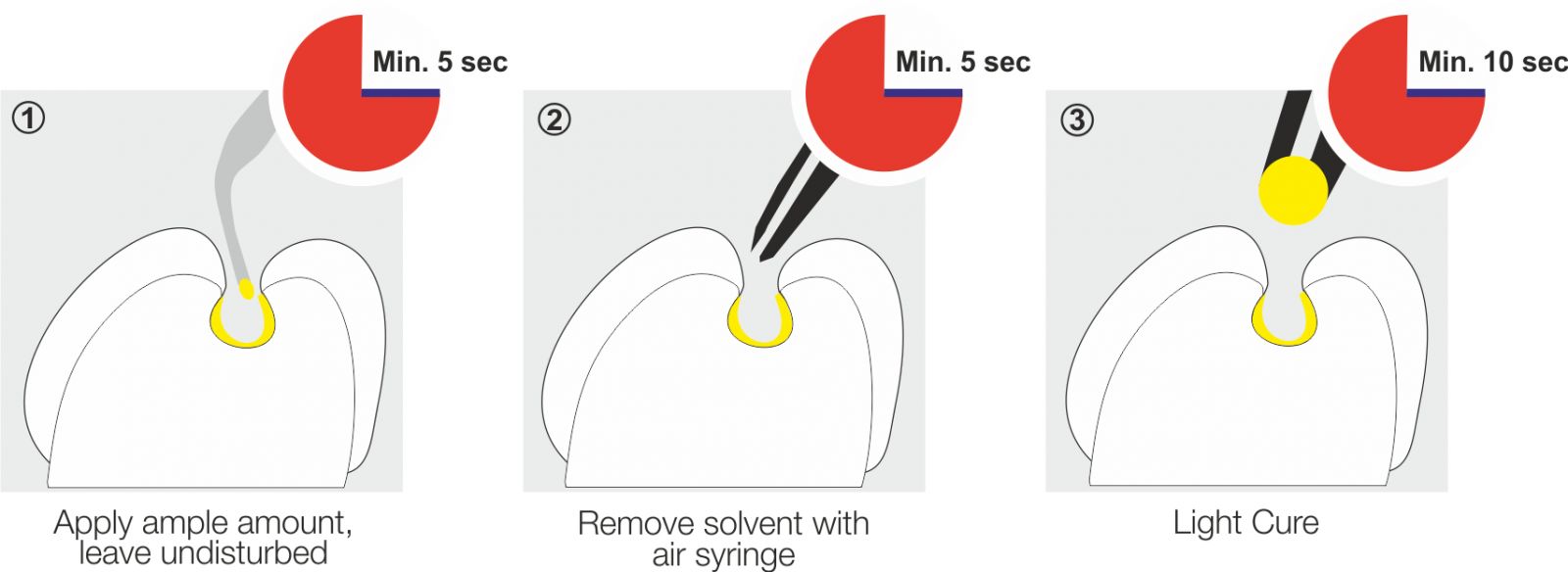 thumbnail interactive-video image 1 of Sky Choice 5th Gen Light Cure Dental Adhesive – 1 Step Bonding – Fresh Stock 1 of 2